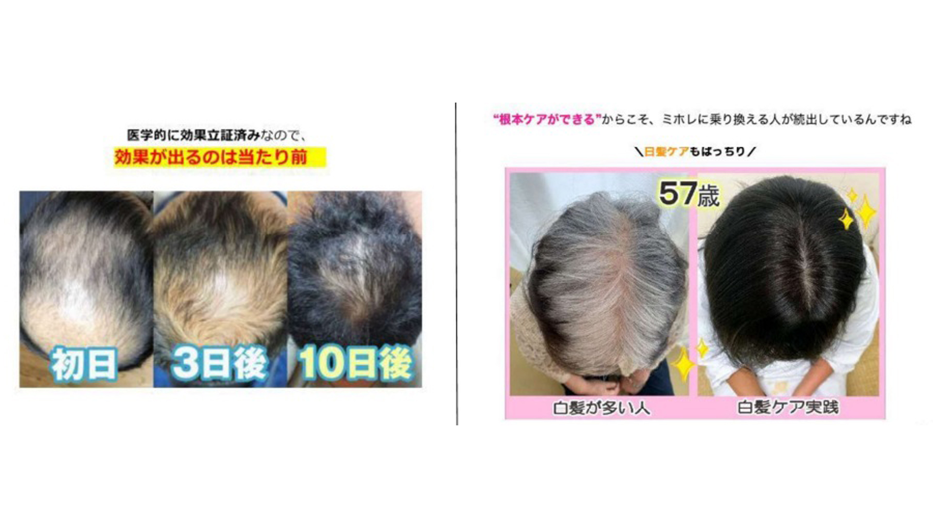 アフィリエイト広告で育毛剤の不当表示 通販会社のヴィワンアークスに